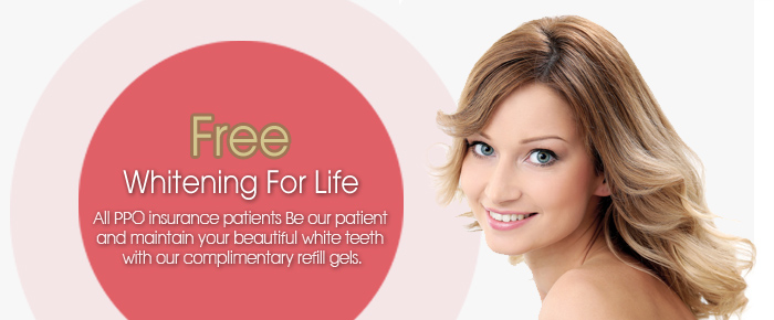 Free whitening for life