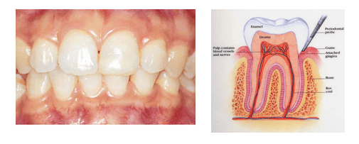 Healthy gums