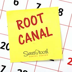 Root Canal